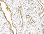 SMARCA1 Antibody in Immunohistochemistry (Paraffin) (IHC (P))