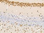 SMARCA1 Antibody in Immunohistochemistry (Paraffin) (IHC (P))