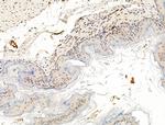 SMARCA1 Antibody in Immunohistochemistry (Paraffin) (IHC (P))