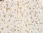 SMARCA1 Antibody in Immunohistochemistry (Paraffin) (IHC (P))