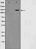 SMC1 Polyclonal Antibody