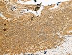 SMC2 Polyclonal Antibody