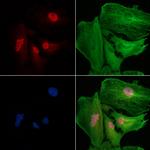 SMG1 Polyclonal Antibody