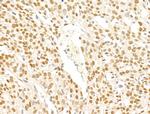 SMG1 Antibody in Immunohistochemistry (Paraffin) (IHC (P))