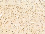 SMG1 Antibody in Immunohistochemistry (Paraffin) (IHC (P))