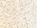 SMG1 Antibody in Immunohistochemistry (Paraffin) (IHC (P))
