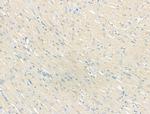 Smoothelin Antibody in Immunohistochemistry (Paraffin) (IHC (P))