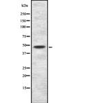 SMYD2 Polyclonal Antibody