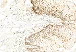 SNAIL Antibody in Immunohistochemistry (Paraffin) (IHC (P))