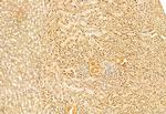 SNAIL Antibody in Immunohistochemistry (Paraffin) (IHC (P))