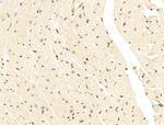 SNRNP200 Antibody in Immunohistochemistry (Paraffin) (IHC (P))