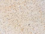 SNRNP70 Antibody in Immunohistochemistry (Paraffin) (IHC (P))