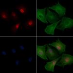 SNRPN Polyclonal Antibody