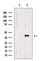SNX6 Antibody in Western Blot (WB)