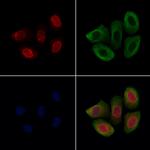 SON Polyclonal Antibody