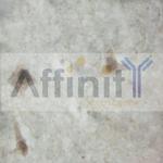 SOX9 Polyclonal Antibody