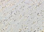 SP6 Polyclonal Antibody