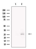 SPC25 Polyclonal Antibody