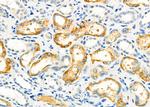 SPG11 Polyclonal Antibody