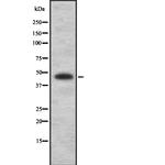 SSB Antibody in Western Blot (WB)