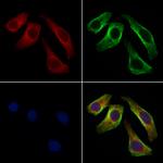 STAM Polyclonal Antibody