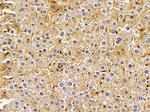 STEAP3 Polyclonal Antibody