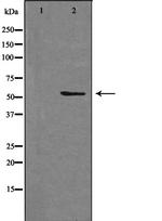 STEAP3 Polyclonal Antibody