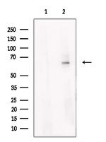STS Antibody in Western Blot (WB)