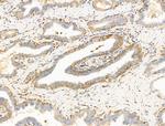 SUCLG1 Polyclonal Antibody