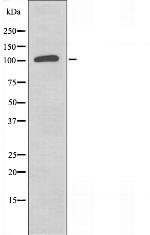 SUPT16H Antibody in Western Blot (WB)
