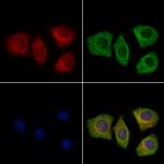 SFTPA2 Polyclonal Antibody