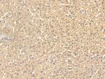 SFTPA2 Antibody in Immunohistochemistry (Paraffin) (IHC (P))