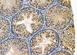 SUV39H1 Antibody in Immunohistochemistry (Paraffin) (IHC (P))