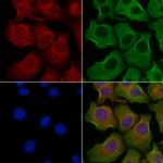 Synaptojanin 1 Polyclonal Antibody