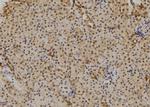 TAB1 Polyclonal Antibody