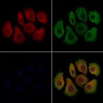 CCDC44 Polyclonal Antibody