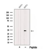 CCDC44 Antibody in Western Blot (WB)