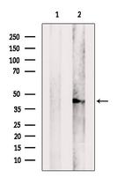 CCDC44 Antibody in Western Blot (WB)
