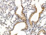 TBL1X Antibody in Immunohistochemistry (Paraffin) (IHC (P))