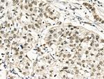 TBP Antibody in Immunohistochemistry (Paraffin) (IHC (P))