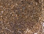 TBP Antibody in Immunohistochemistry (Paraffin) (IHC (P))