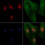 TBX2/3 Polyclonal Antibody