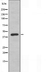 TBX10 Polyclonal Antibody