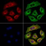 TCTEX1D2 Polyclonal Antibody