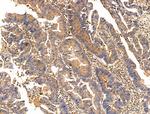 TCTEX1D2 Antibody in Immunohistochemistry (Paraffin) (IHC (P))