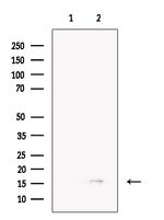 TCTEX1D2 Antibody in Western Blot (WB)