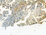 TDP1 Polyclonal Antibody