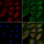 TNN Polyclonal Antibody