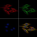 Tensin 1 Polyclonal Antibody