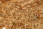 TET2 Antibody in Immunohistochemistry (Paraffin) (IHC (P))